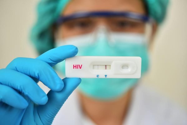 Lab technician holding HIV rapid device test